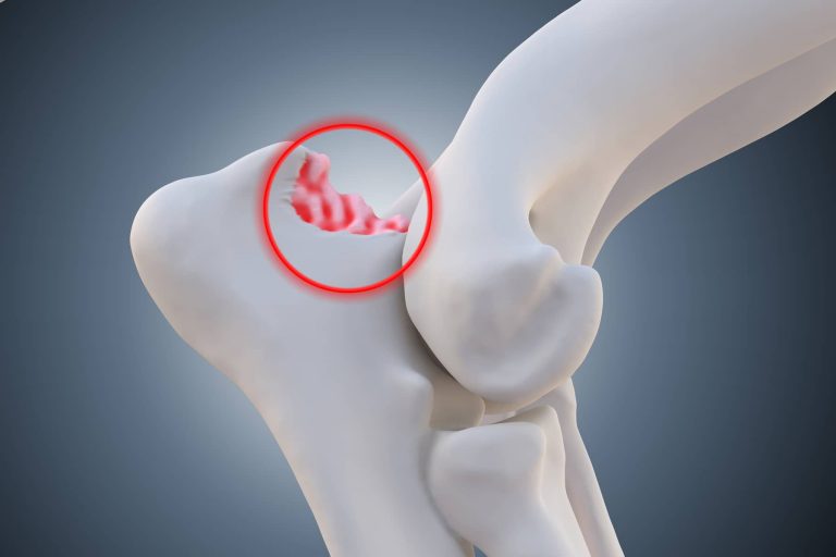 ununited anconeal process in dogs