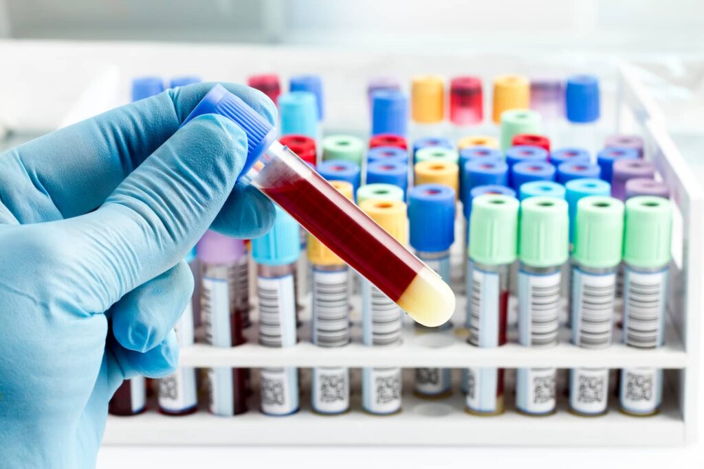 pre-anesthetic bloodwork in pets